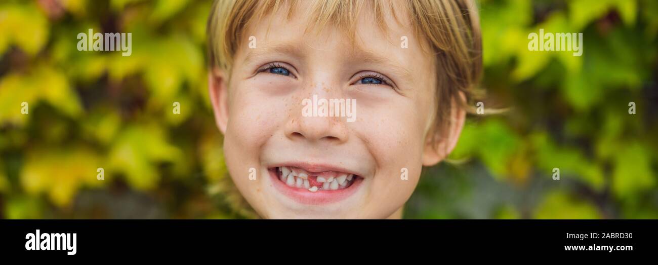 Petit Garcon Enfant Souriant Main Pointant Son Premier Bebe Du Lait Ou De La Dent Temporaire Fall Out Banner Format Long Photo Stock Alamy