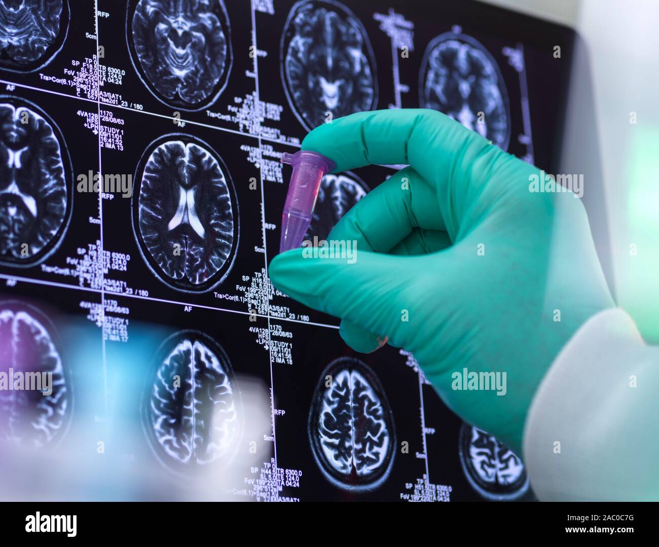 Neurology research, conceptual image. Préparer un échantillon scientifique en face de la scintigraphie cérébrale. Banque D'Images