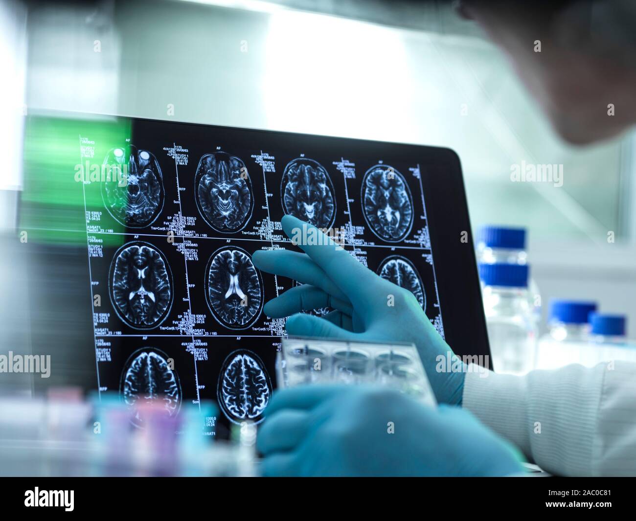 Neurology research, conceptual image. La préparation d'un scientifique bien multi plate en face de scans du cerveau. Banque D'Images