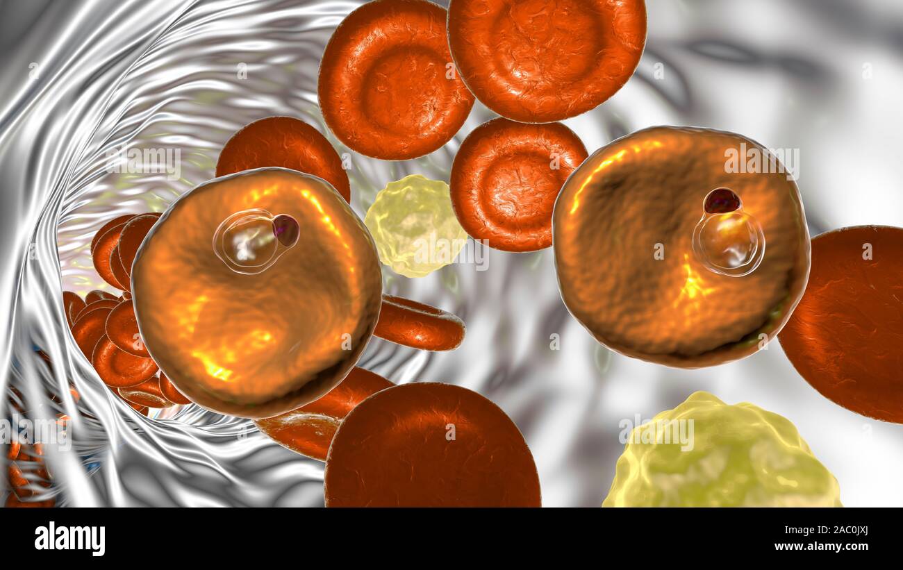 Plasmodium vivax dans les globules rouges, illustration Banque D'Images