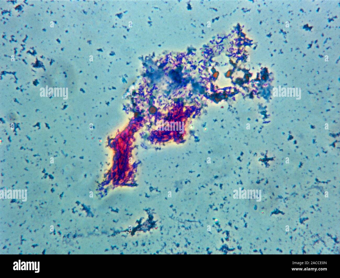 Microphotographie lumière d'une grappe de Mycobacterium tuberculosis, le bacille de la tige-comme les bactéries qui causent la tuberculose chez l'homme. Cette bactérie forme fil Banque D'Images