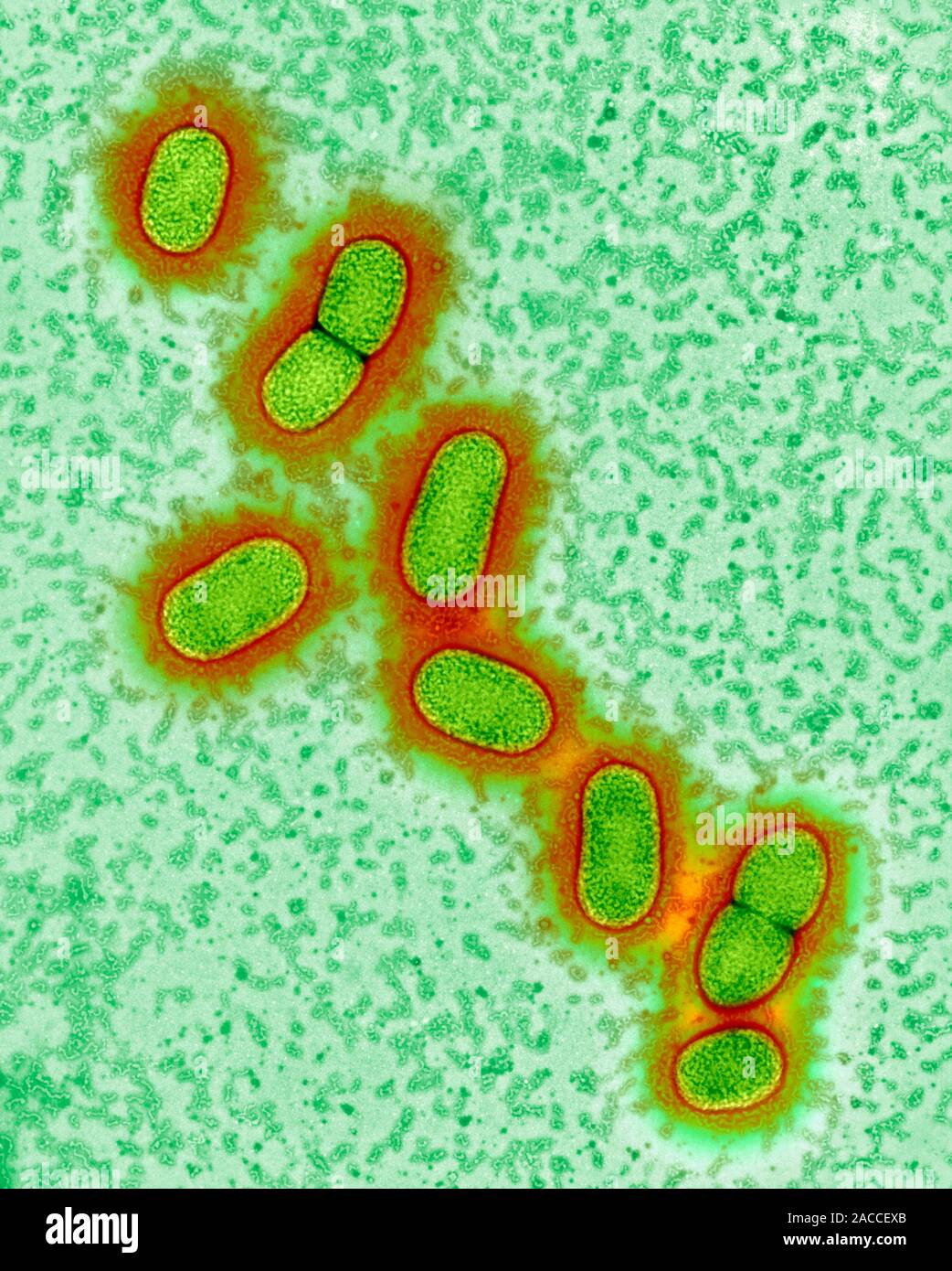 Bacteroides Gingivalis, Bacteroides Asaccharolyticus – IQLZ