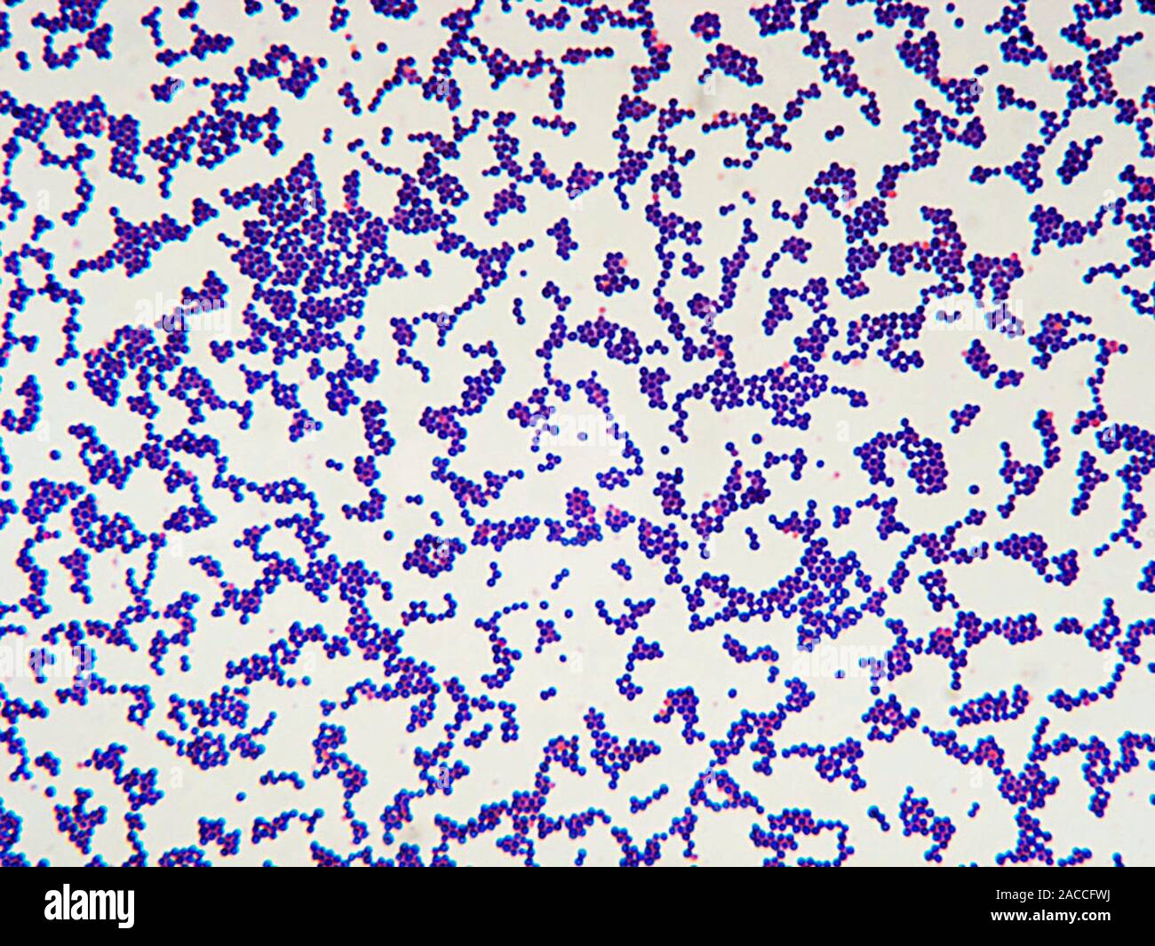 Staphylococcus aureus, lumière microphotographie. Ces cocci Gram positif (ronde) se trouvent sur