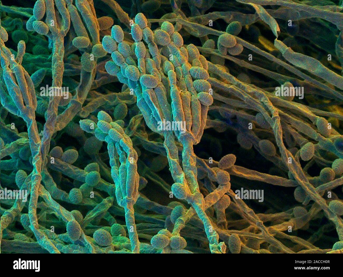 le-penicillium-couleur-de-l-analyse-des-lectrons-microphotographie