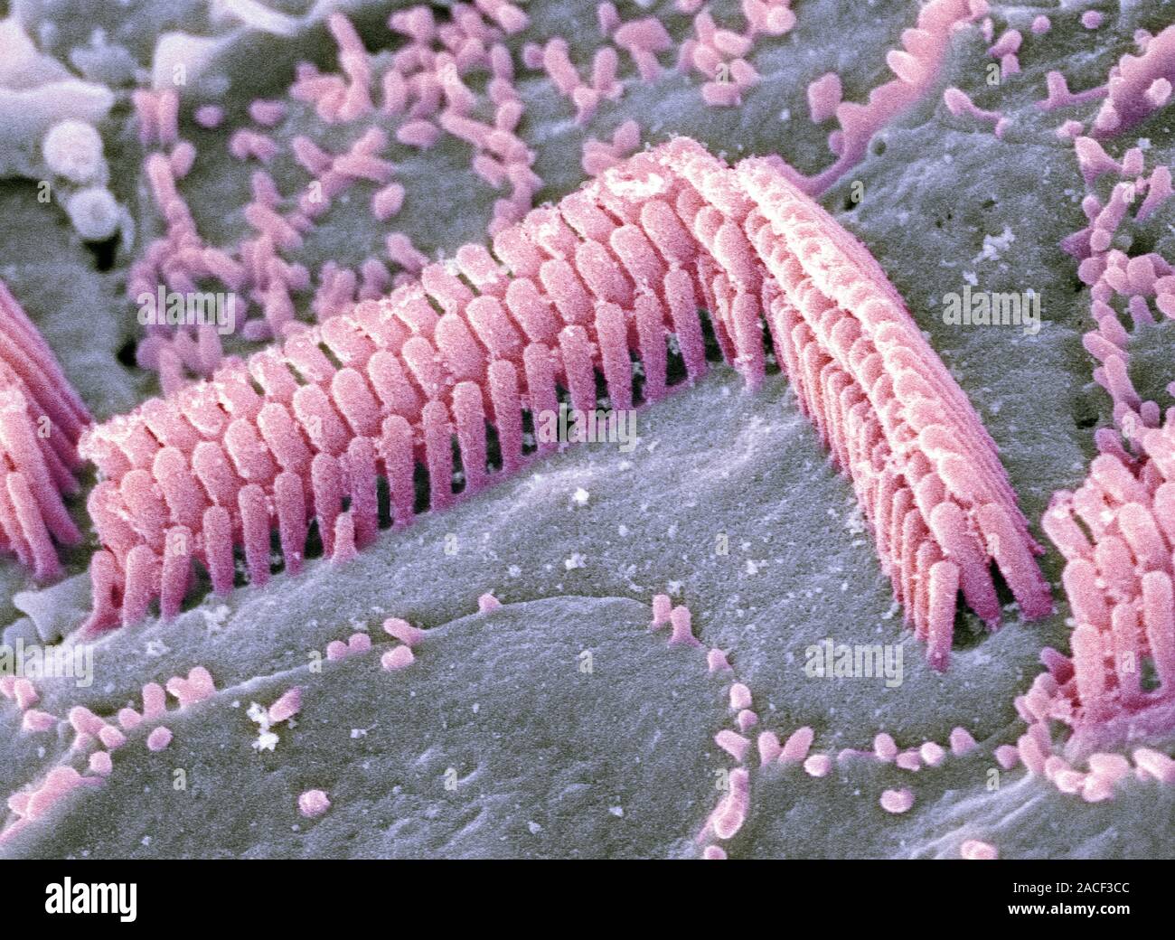 Les cellules ciliées de l'oreille interne. Couleur de l'analyse des ...