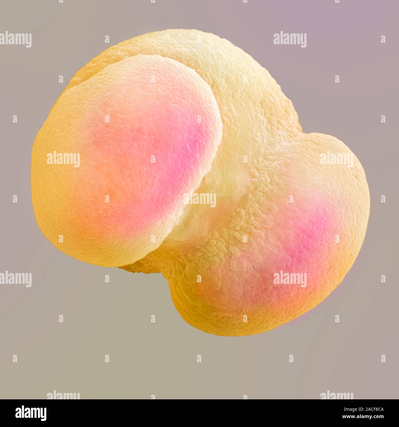 Pollen de pin, SEM Photo Stock - Alamy