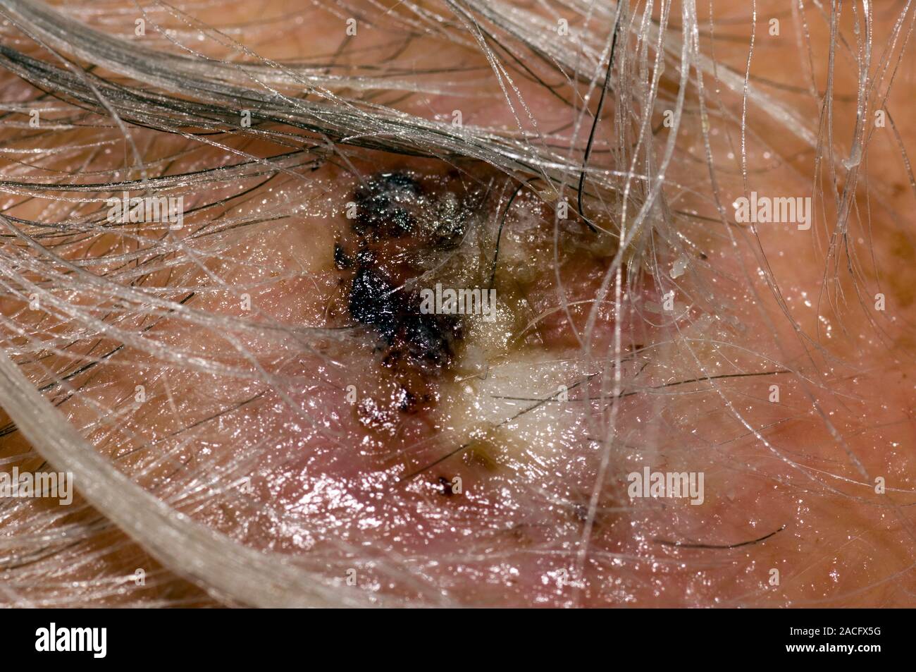 Closeup d