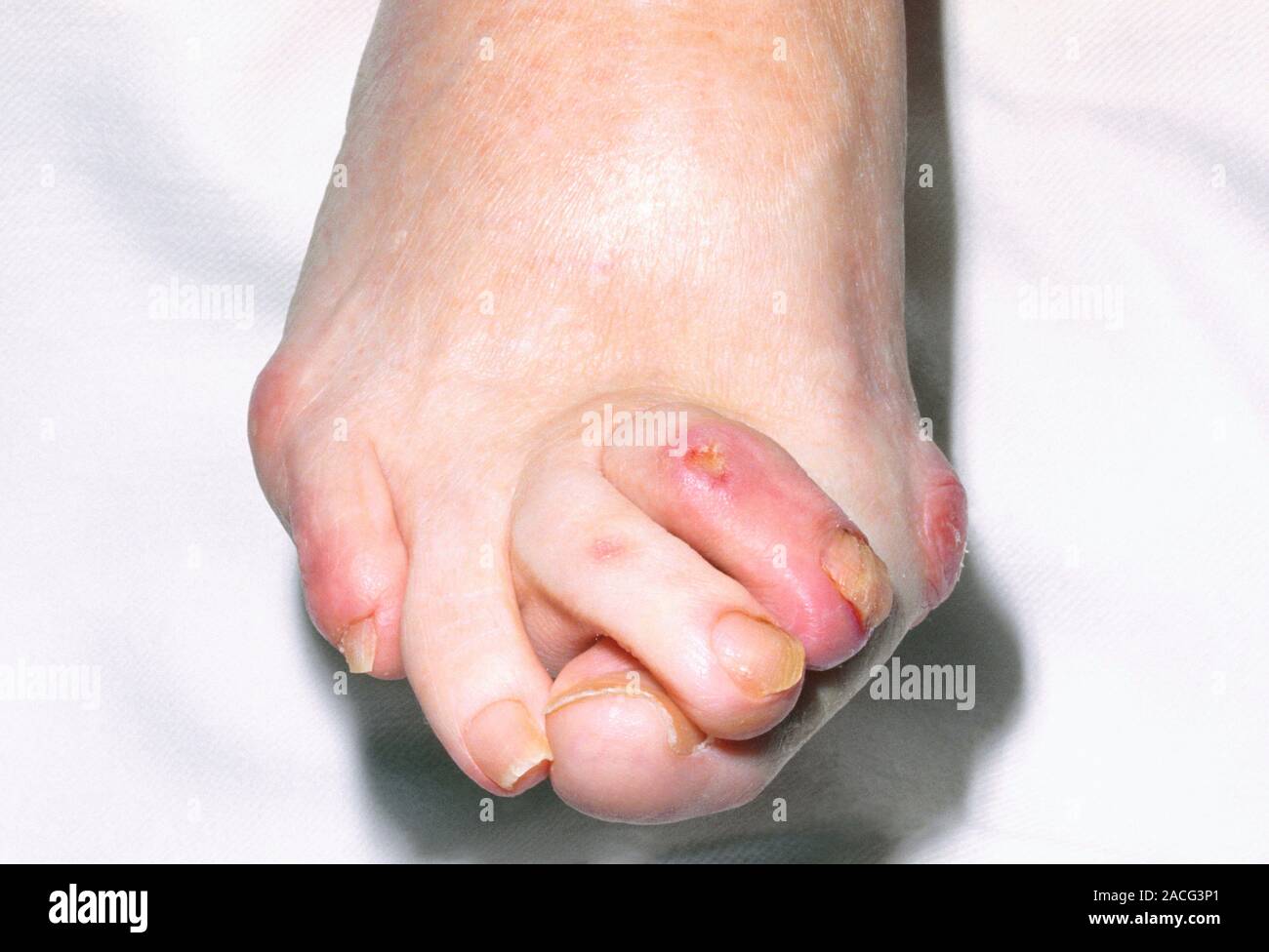 Oignon pied talon sale