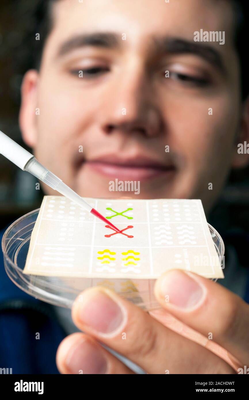 Paper laboratoires sur puce. Solution de couleur chute Chercheur sur papier à un dispositif microfluidique, également connu sous le nom de laboratoires sur puce. Cet appareil est formé pour Banque D'Images
