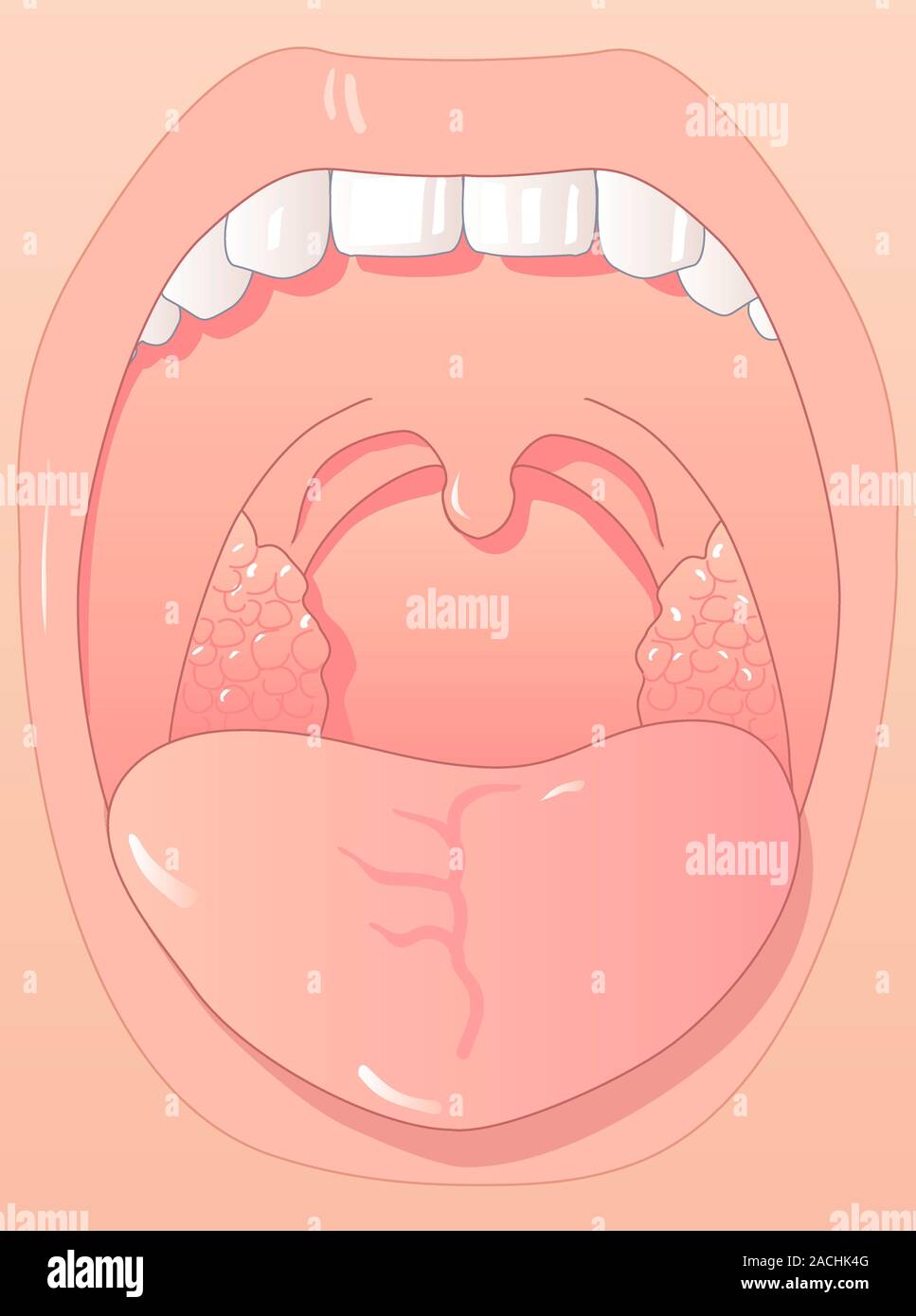 Bouche saine. Illustration de l'intérieur d'une bouche saine. D'un côté ou  à l'arrière de la bouche sont les amygdales, masses de tissu lymphoïde.  Entre Photo Stock - Alamy