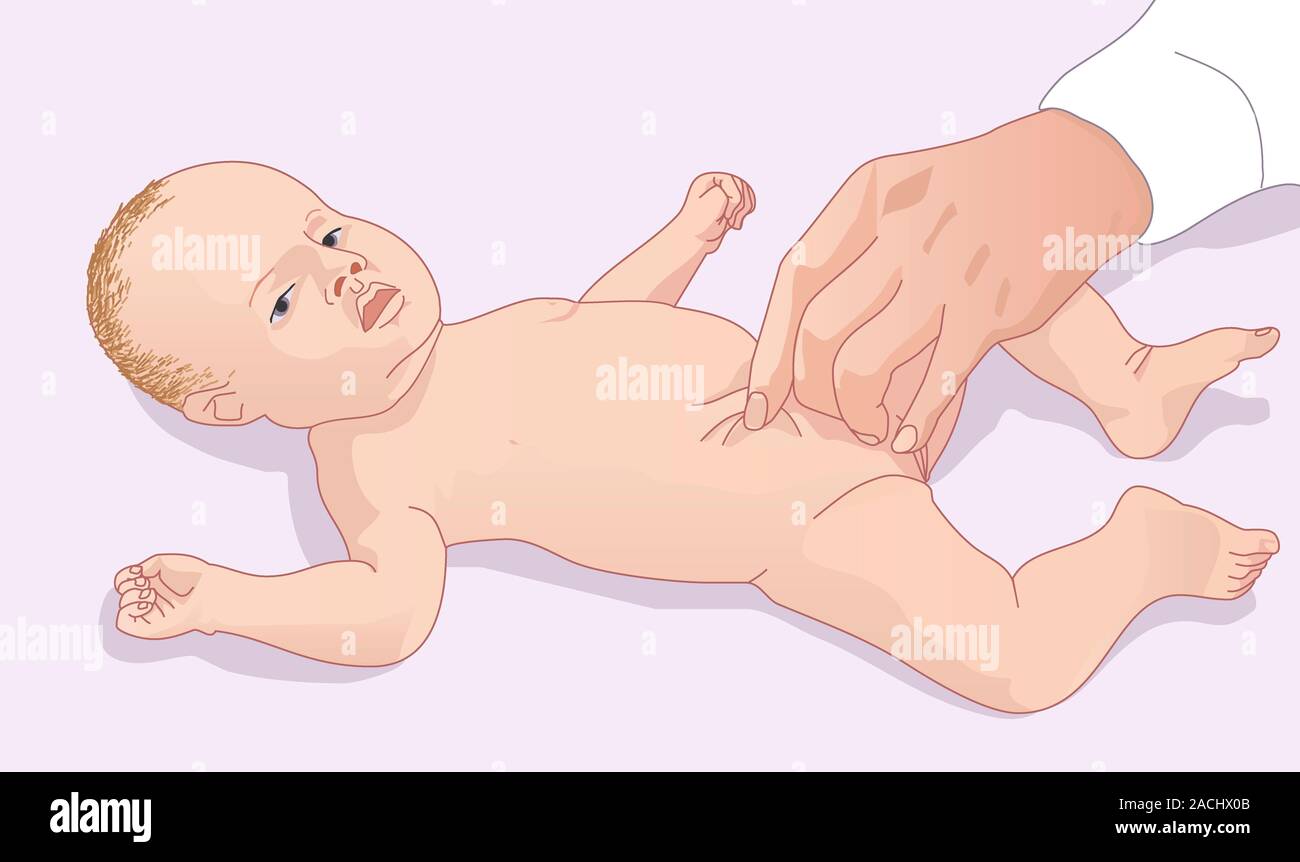 Pincer La Peau Pour Tester La Deshydratation L Oeuvre De L Ordinateur D Un Medecin De Pincer La Peau Du Bebe A Un Test Pour La Deshydratation Plus La Peau Prend Pour Revenir Apres Photo Pincer La Peau Pour Tester La Deshydratation L Oeuvre De L Ordinateur D Un Medecin De Pincer La Peau Du Bebe A Un Test Pour La Deshydratation Plus La Peau Prend Pour Revenir Apres Photo