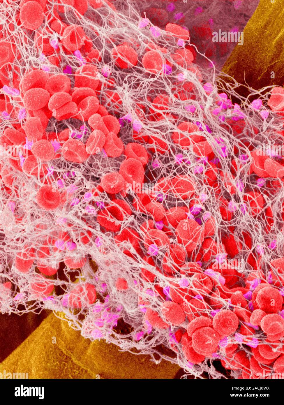 Caillot de sang. Couleur de l