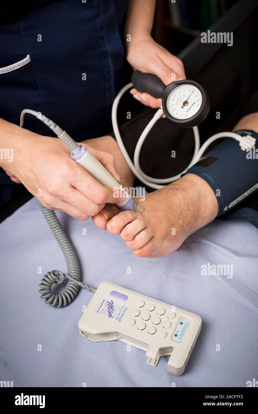 La clinique de diabète, échographie pied scan. Échographie Doppler en cours  pour vérifier l'approvisionnement en sang du pied d'un patient atteint de  diabète. Dam Photo Stock - Alamy