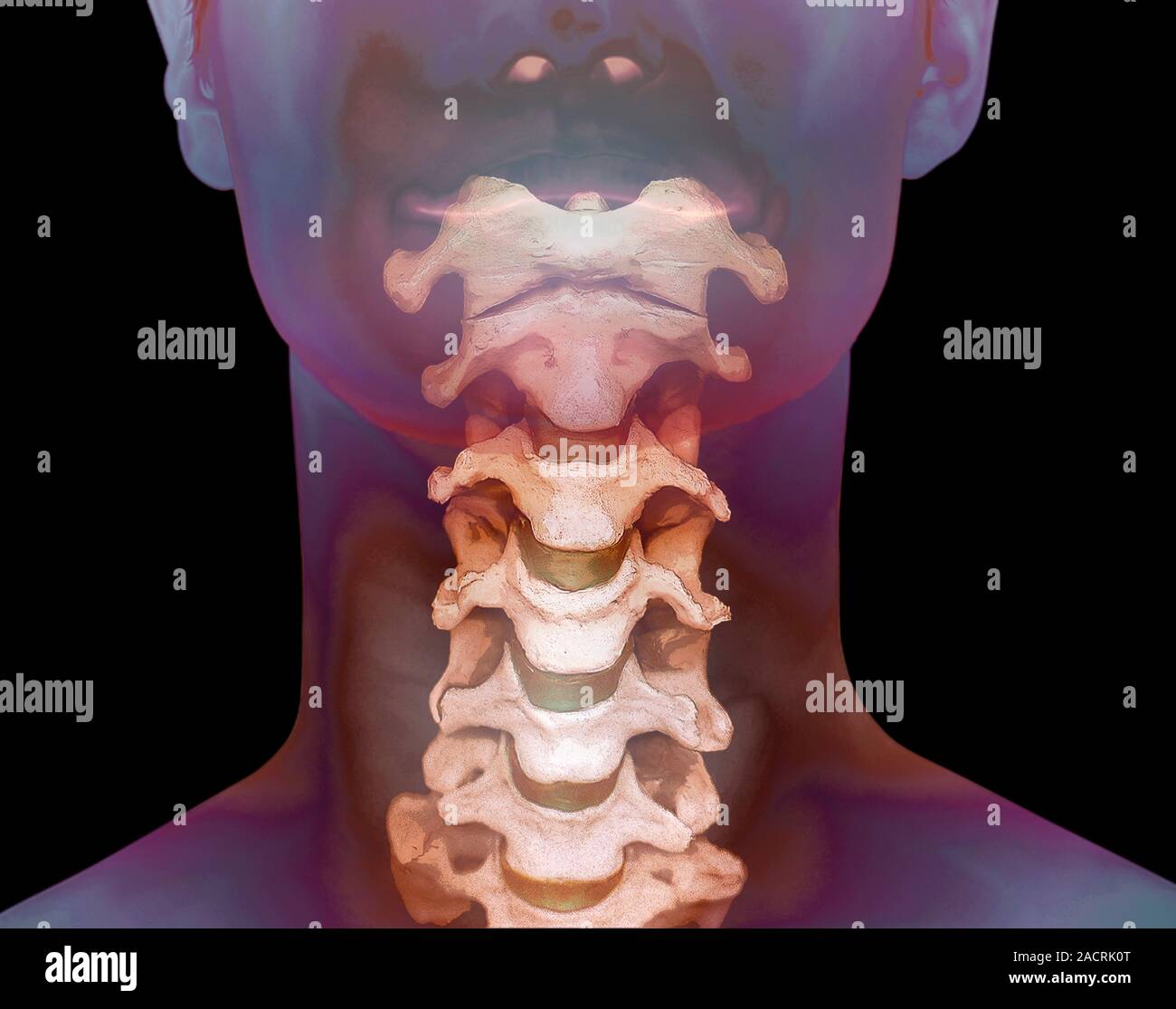 La colonne vertébrale en bonne santé. 3D couleur Scanner de la colonne