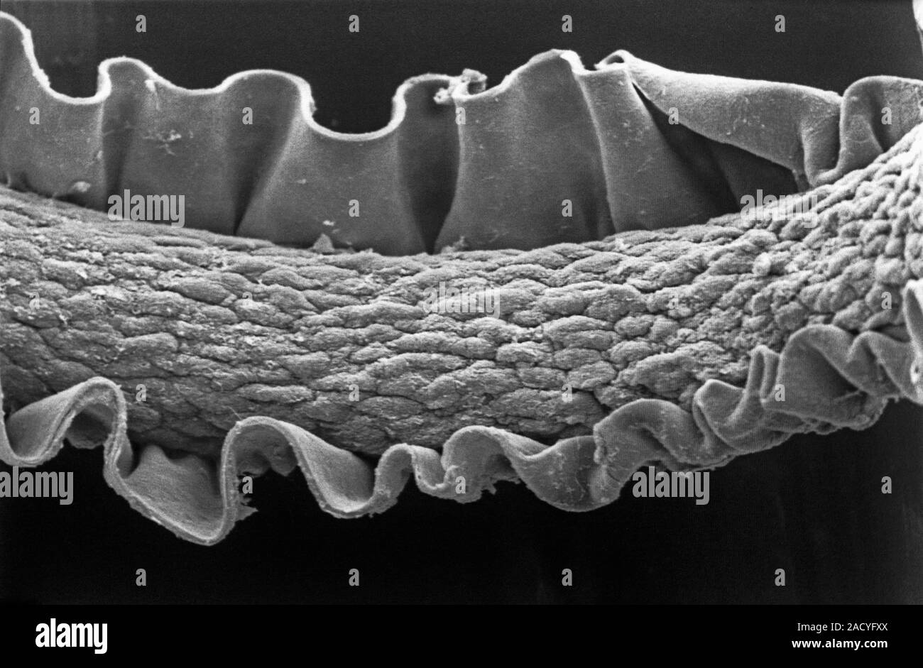 Microscope électronique à balayage (MEB) de droit d'un cheveu humain (x 500  Photo Stock - Alamy