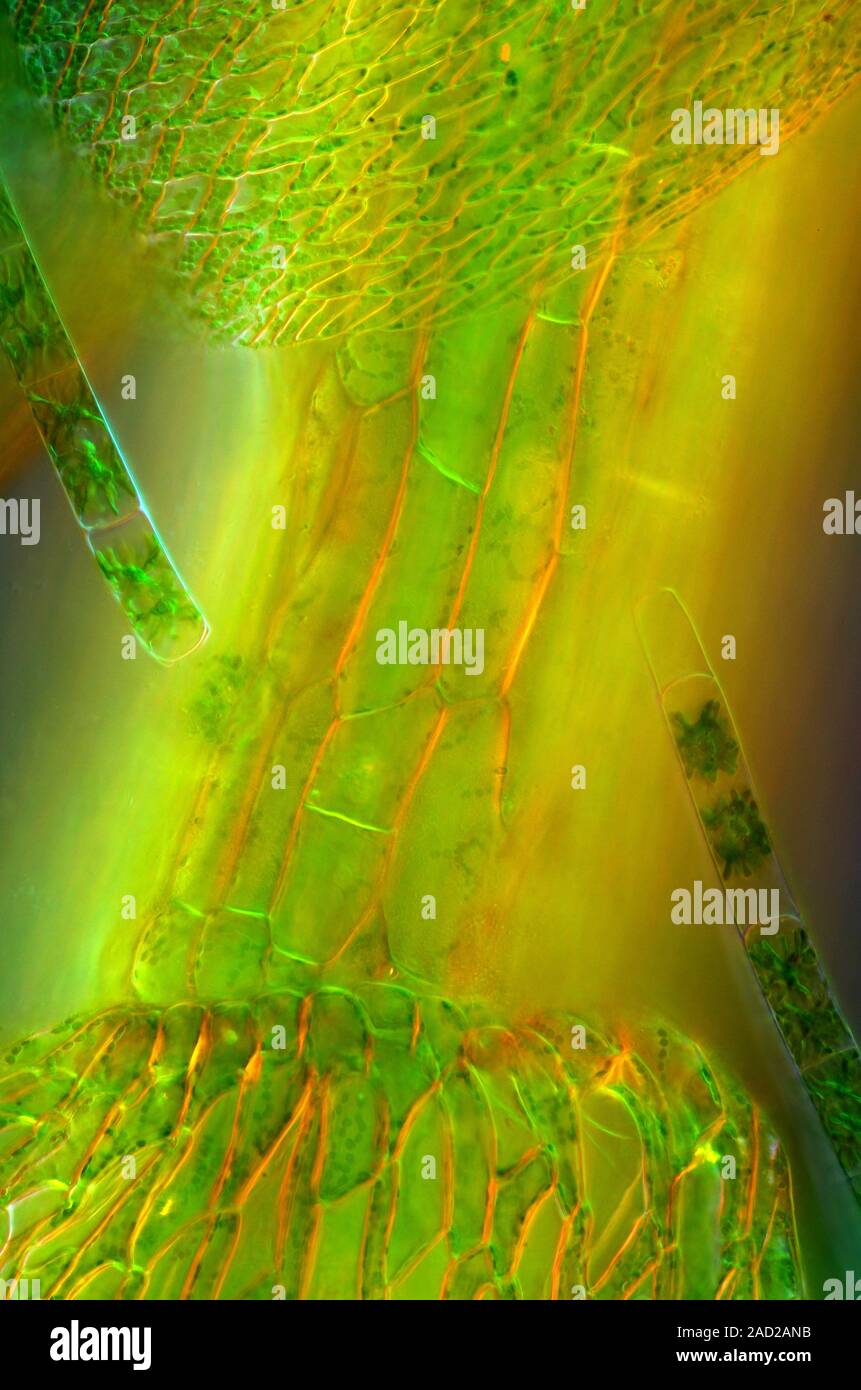 Zygnema algues sur la sphaigne. Darkfield allumé une lumière polarisée microphotographie de Zygnema sp. algues vertes filamenteuses (long, coin supérieur gauche et inférieur ri Banque D'Images
