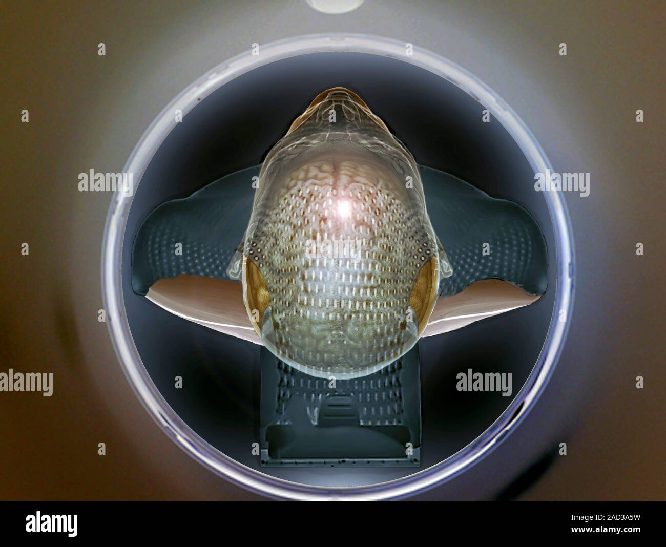Tumeur au cerveau traitement de radiothérapie. 3D computed tomography — free download