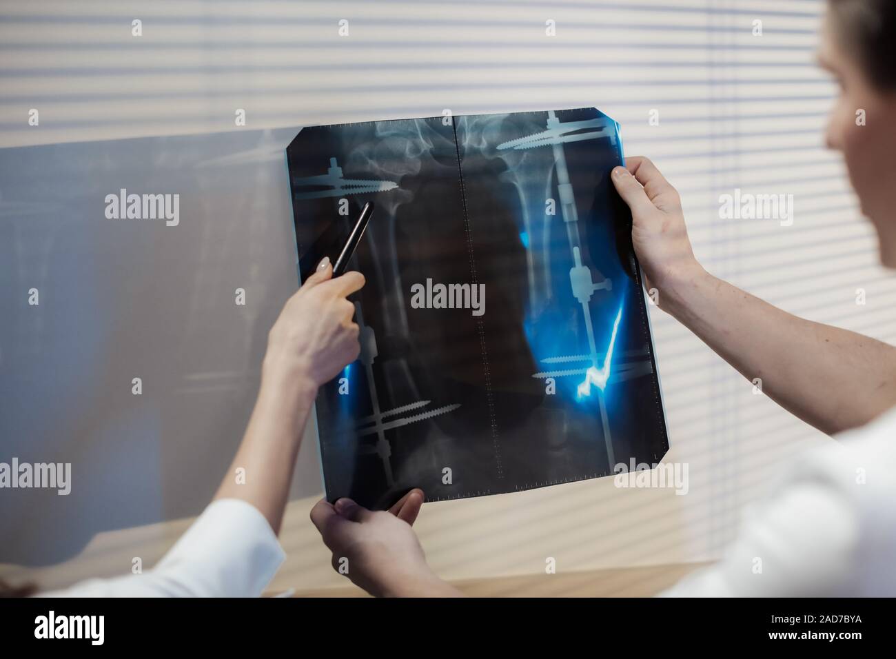 Deux médecins examinent les x-ray photo. Le médecin et l'homme fille discuter du diagnostic. Banque D'Images