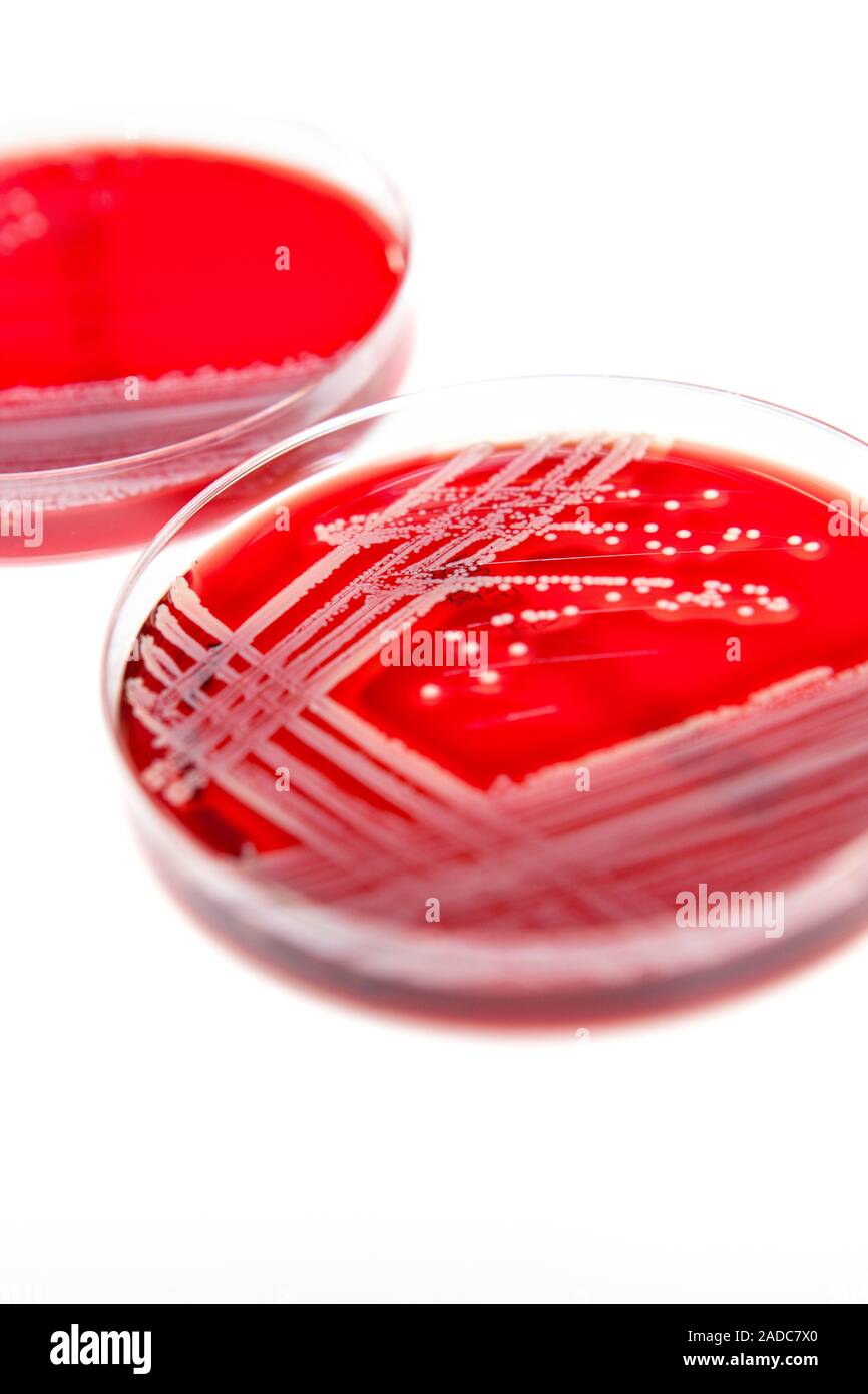 elfbar nachfüll pod läuft aus colonie de bactéries dans une plaque de milieu de culture. coproculture, e. coli 4966524 Photo de stock chez Vecteezy main image 0