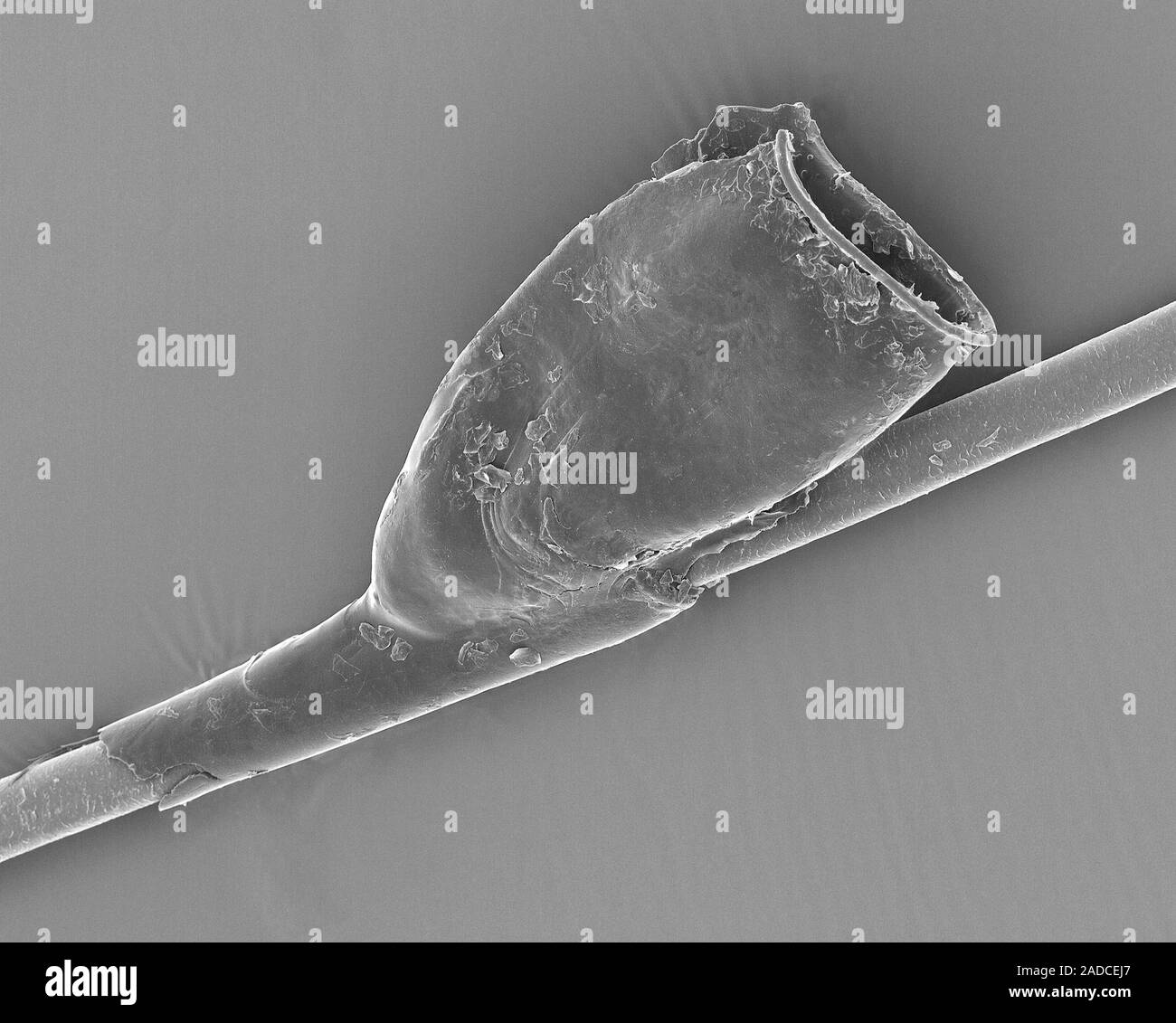 L'analyse des électrons Microphotographie (SEM) de poux de tête humaine ...