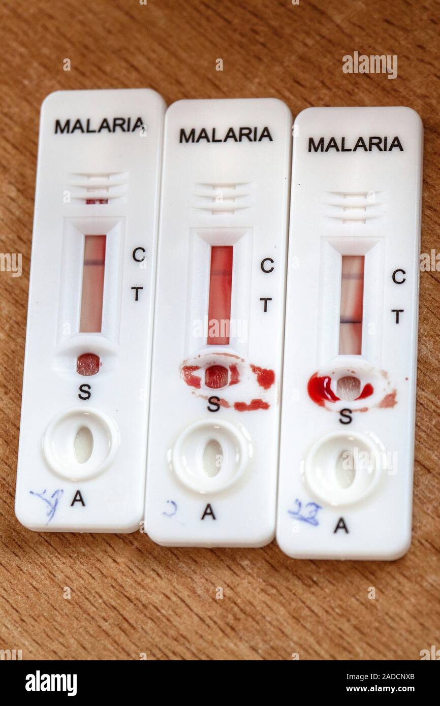 Les bandelettes de test de diagnostic rapide du paludisme. Cet appareil de  contrôle du paludisme est utilisé pour tester le sang d'un patient. Le  dispositif est connu comme un diagnostic rapide du
