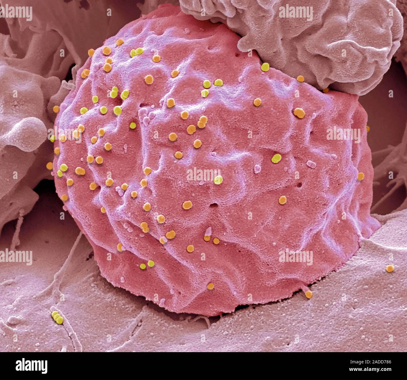 Vecteur viral du VIH. L'analyse des électrons Microphotographie (SEM) de vecteurs viraux basés sur le VIH (virus de l'immunodéficience humaine), l'obtention d'une 293T cell line. Viru Banque D'Images