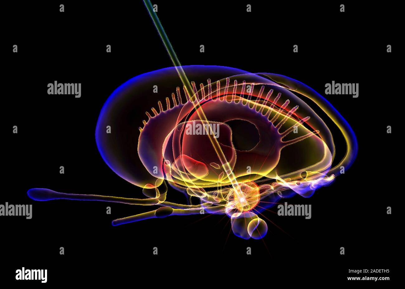 la-stimulation-c-r-brale-profonde-illustration-d-un-syst-me-limbique