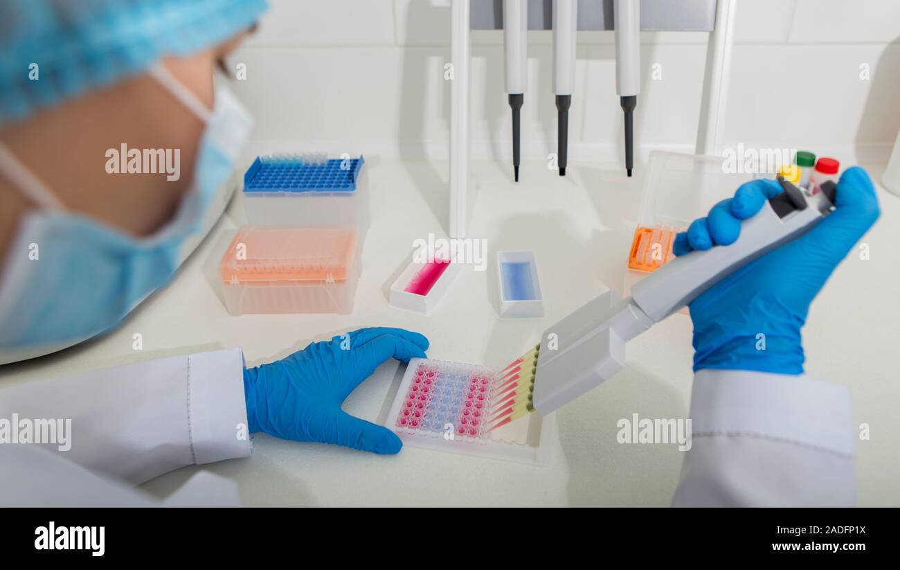 L'assistant médical laissant tomber des échantillons de couleur à partir de la pipette Banque D'Images