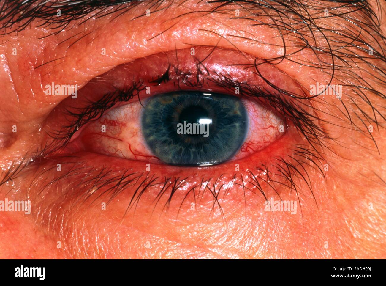 Les bardeaux. Closeup of a rougi yeux causés par l