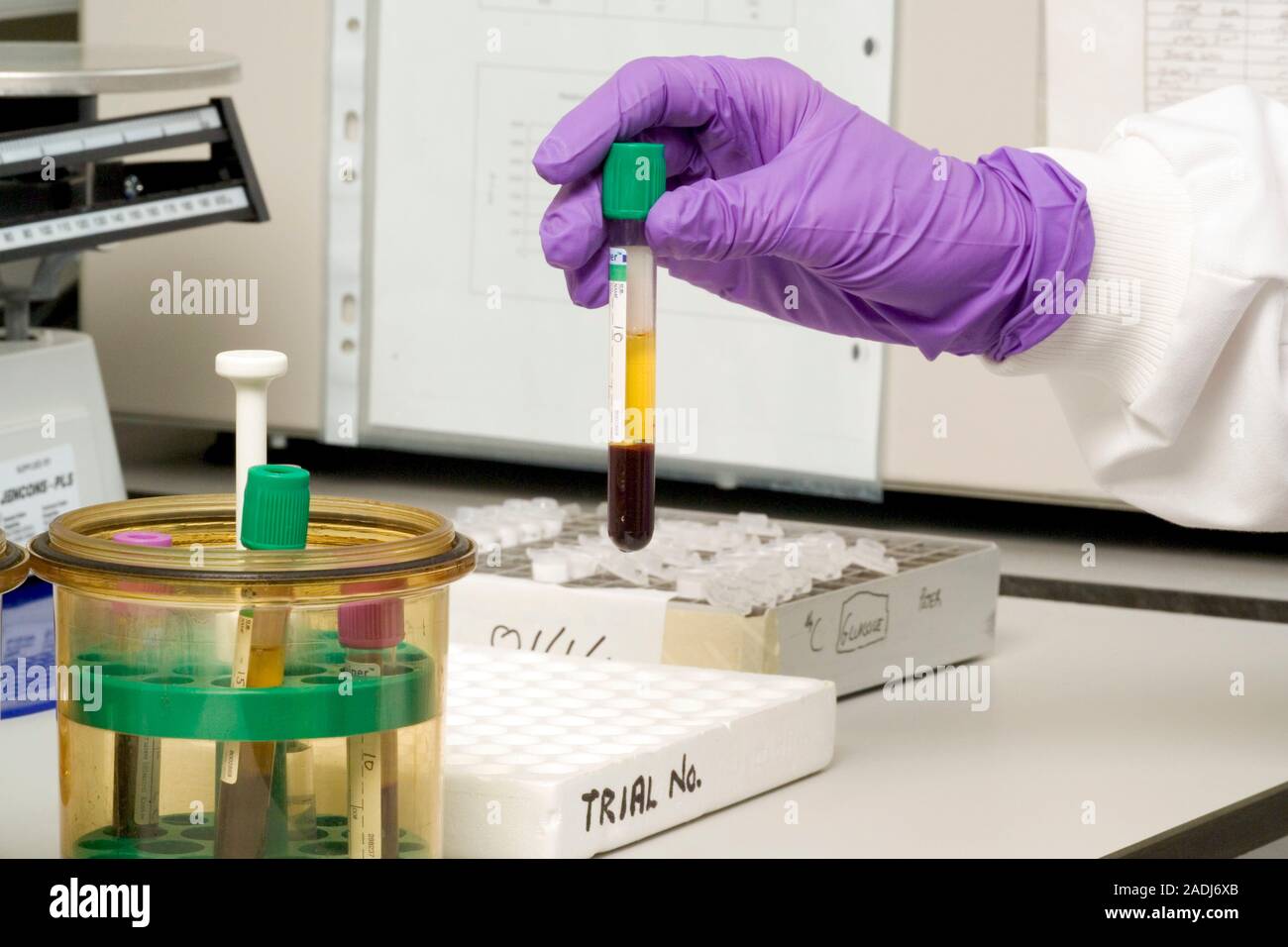sang-centrifug-dans-un-tube-vacutainer-une-centrifugeuse-est-une