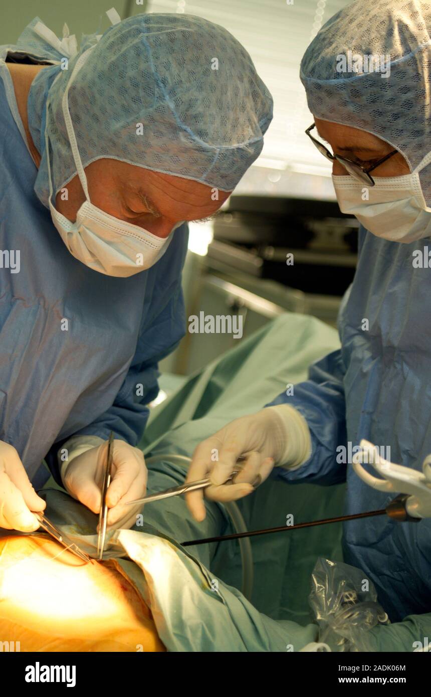 La chirurgie d'un kyste ovarien. De suturer la plaie chirurgien de la — free download