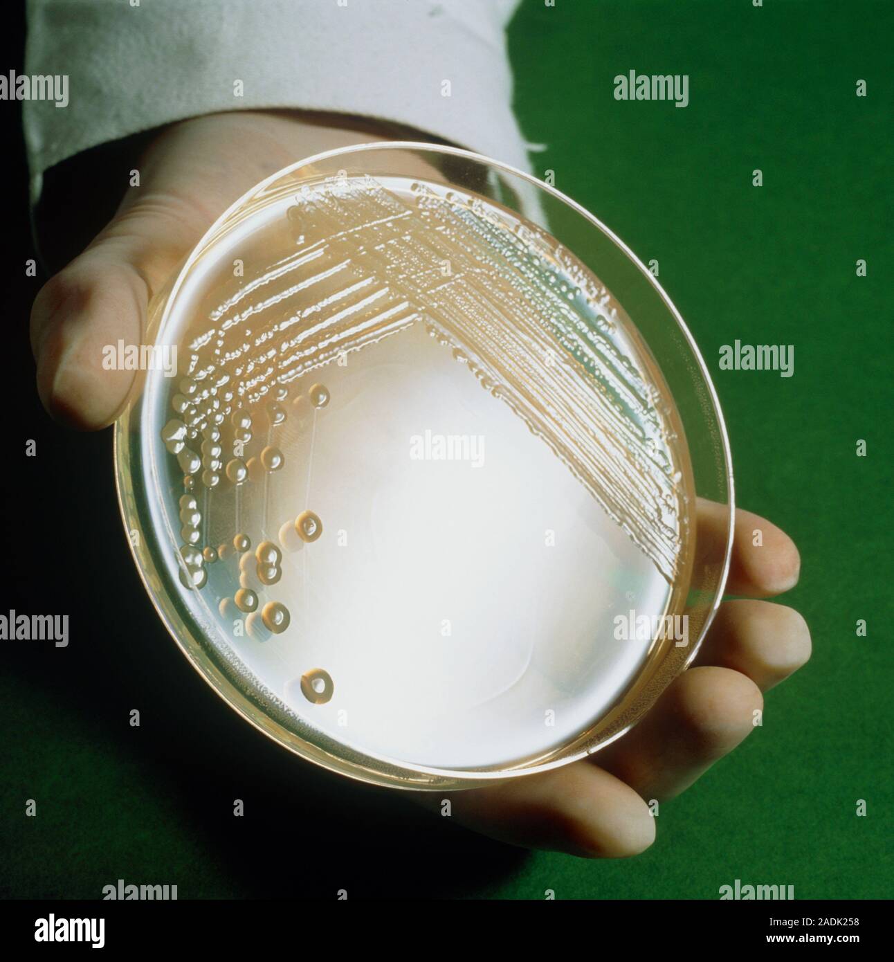 Ptri de la culture de la bactrie Escherichia coli, un laboratoire bien utilis, l'organisme en croissance sur moyenne. La photo montre l'volution des bandes Photo Stock - Alamy Ptri de la culture de la bactrie Escherichia coli, un laboratoire bien utilis, l'organisme en croissance sur moyenne. La photo montre l'volution des bandes Photo Stock - Alamy