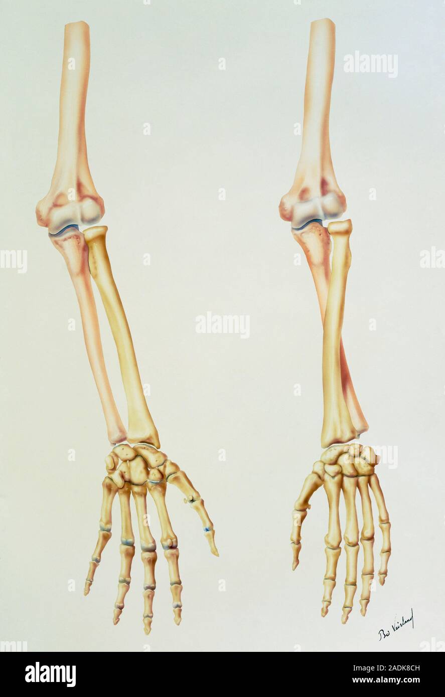 Squelette de bras. Illustration de l'os du bras, montrant leur position en  supination et pronation. En supination (gauche) la paume vers le haut, je  visages Photo Stock - Alamy