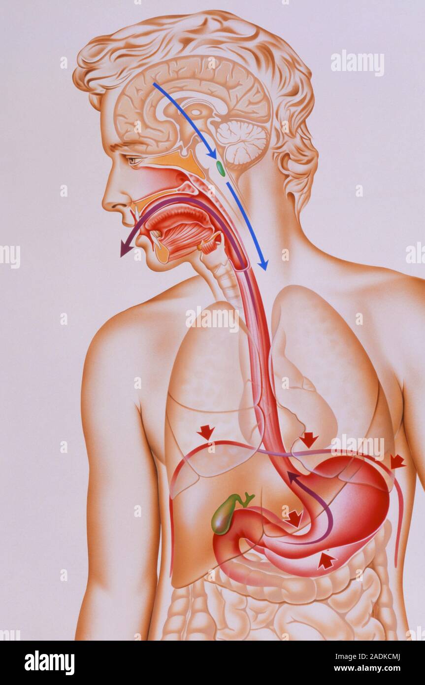 Des vomissements. Illustration du mécanisme qui provoque des vomissements  dans le corps humain. Une impulsion de l'avant du cerveau a stimulé le  vomissement cen Photo Stock - Alamy