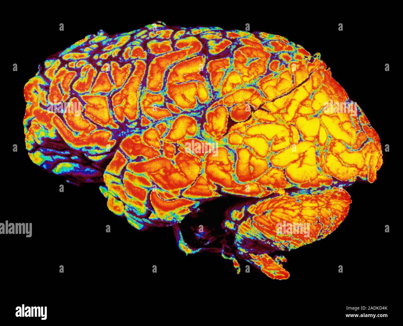 Cerveau humain. Ordinateur image numérisée d'un cerveau humain en bonne santé, en vue de côté. L'anatomie externe du côté gauche du cerveau est vu. Le cerveau Banque D'Images