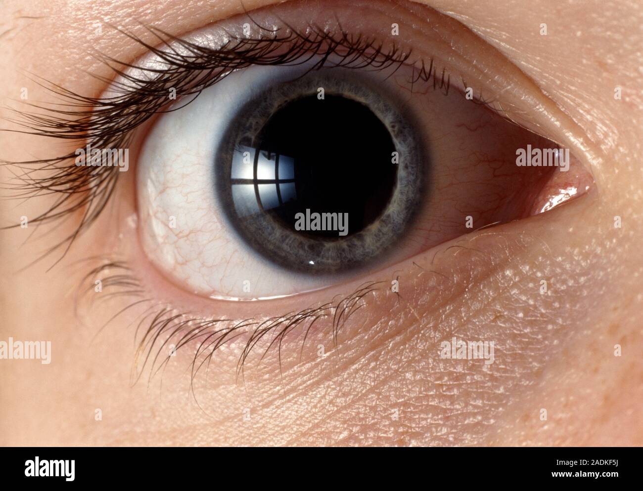 Pupille dilatée. Closeup d'un œil humain avec une pupille dilatée