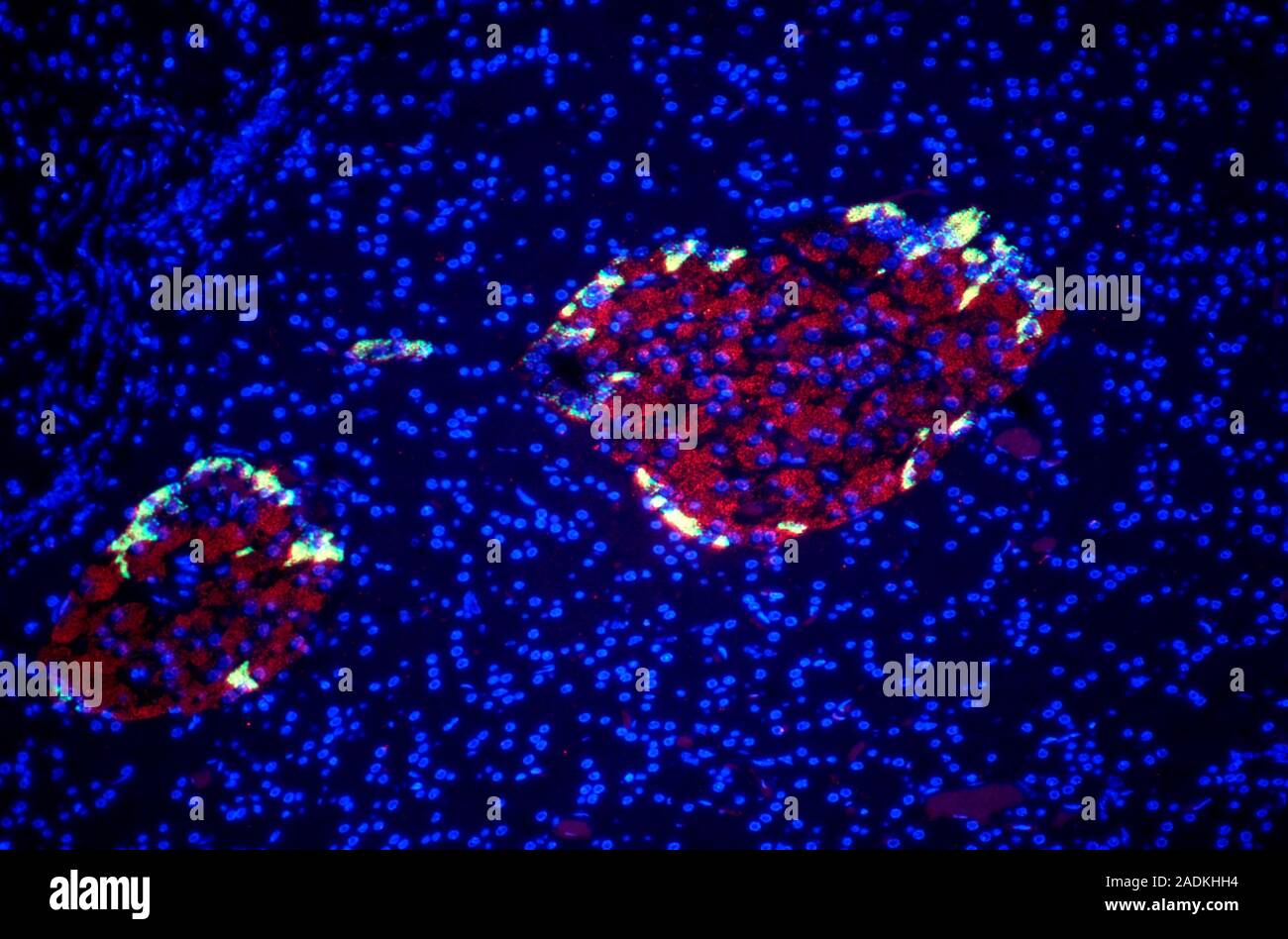 Les Cellules Pancr atiques La Lumi re Fluorescente Microphotographie les-cellules-pancr-atiques-la-lumi-re-fluorescente-microphotographie