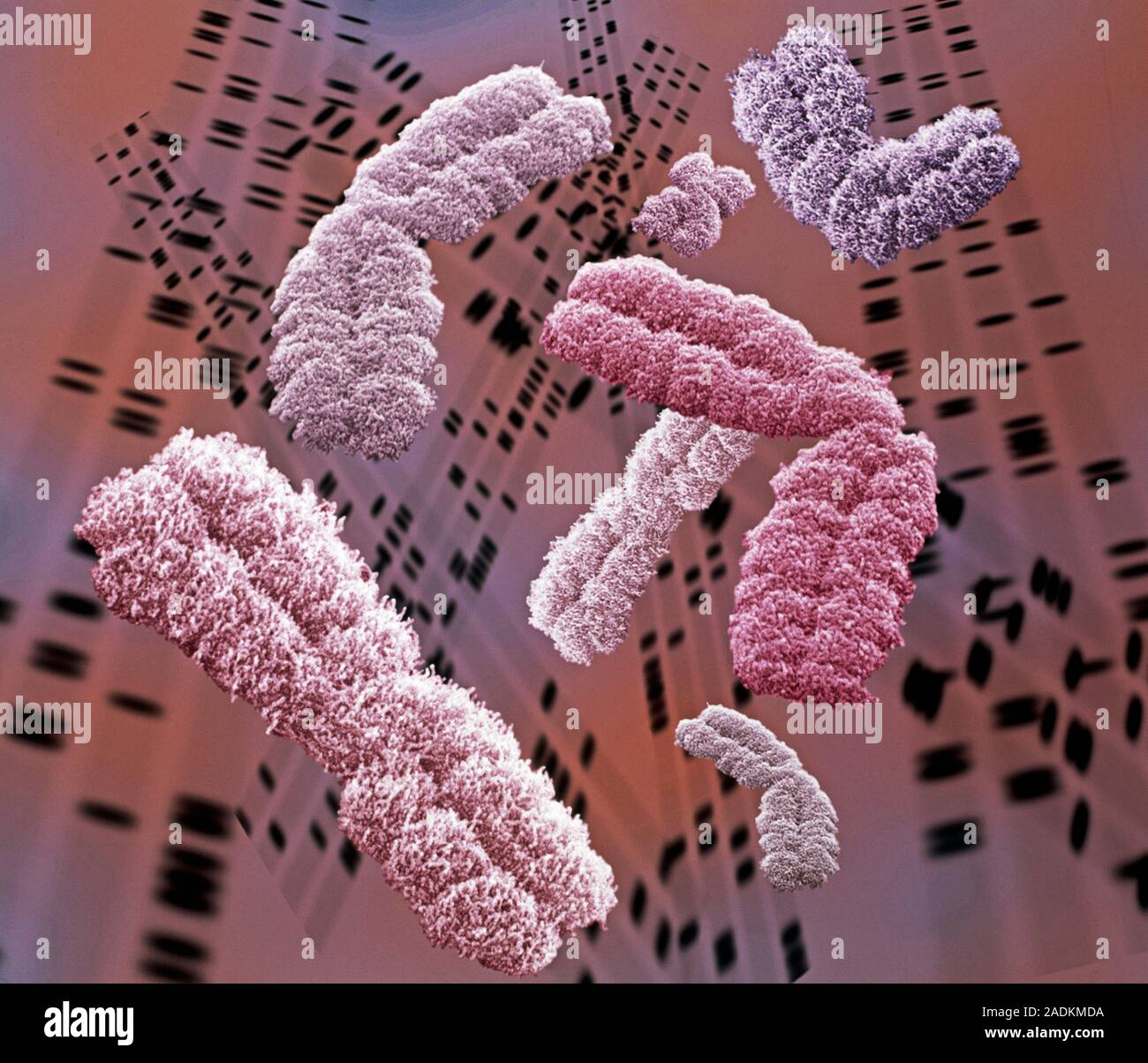 Les chromosomes. Couleur de l'analyse des électrons Microphotographie (SEM) de chromosomes. La MEB est superposée sur un fond autoradiogram de l'ADN. Les chromosomes contiennent des th Banque D'Images