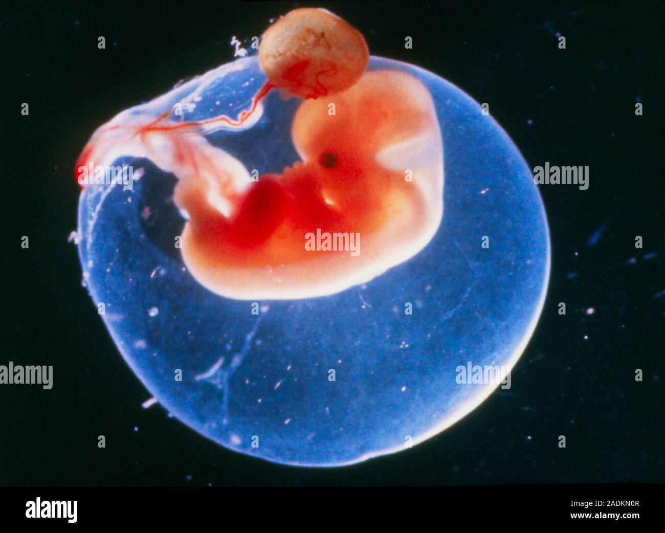L'embryon humain  environ 6 semaines, entour par le sac amniotique  remplie de liquide, avec le reste de la vsicule vitelline encore attach  (au-dessus de la tte). L'umbi Photo Stock - Alamy