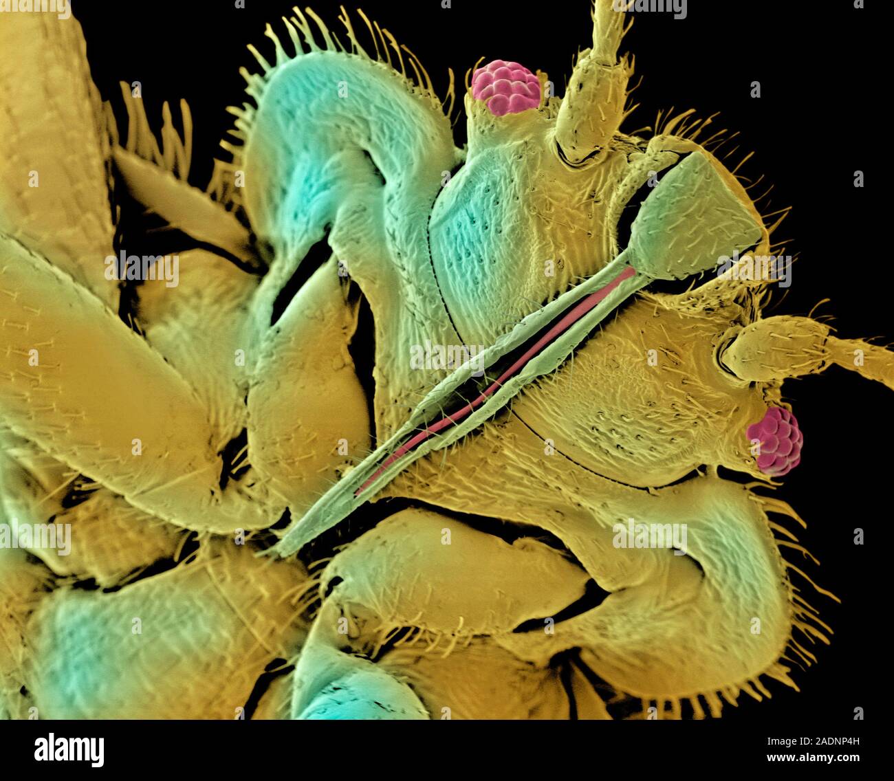 Punaise de lit. Couleur de l'analyse des électrons Microphotographie (SEM) de la tête d'une punaise de lit (Cimex lectularius). Il a un œil composé (rose) de chaque côté o Banque D'Images