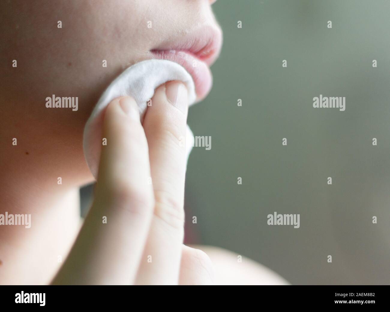 L'adolescent appuie sur un coton de lait de toilette sur son visage.La lutte contre l'acné. Banque D'Images