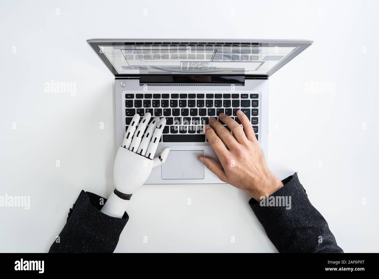 Homme avec prothèse de main travaillant sur ordinateur portable. Membre artificiel Banque D'Images