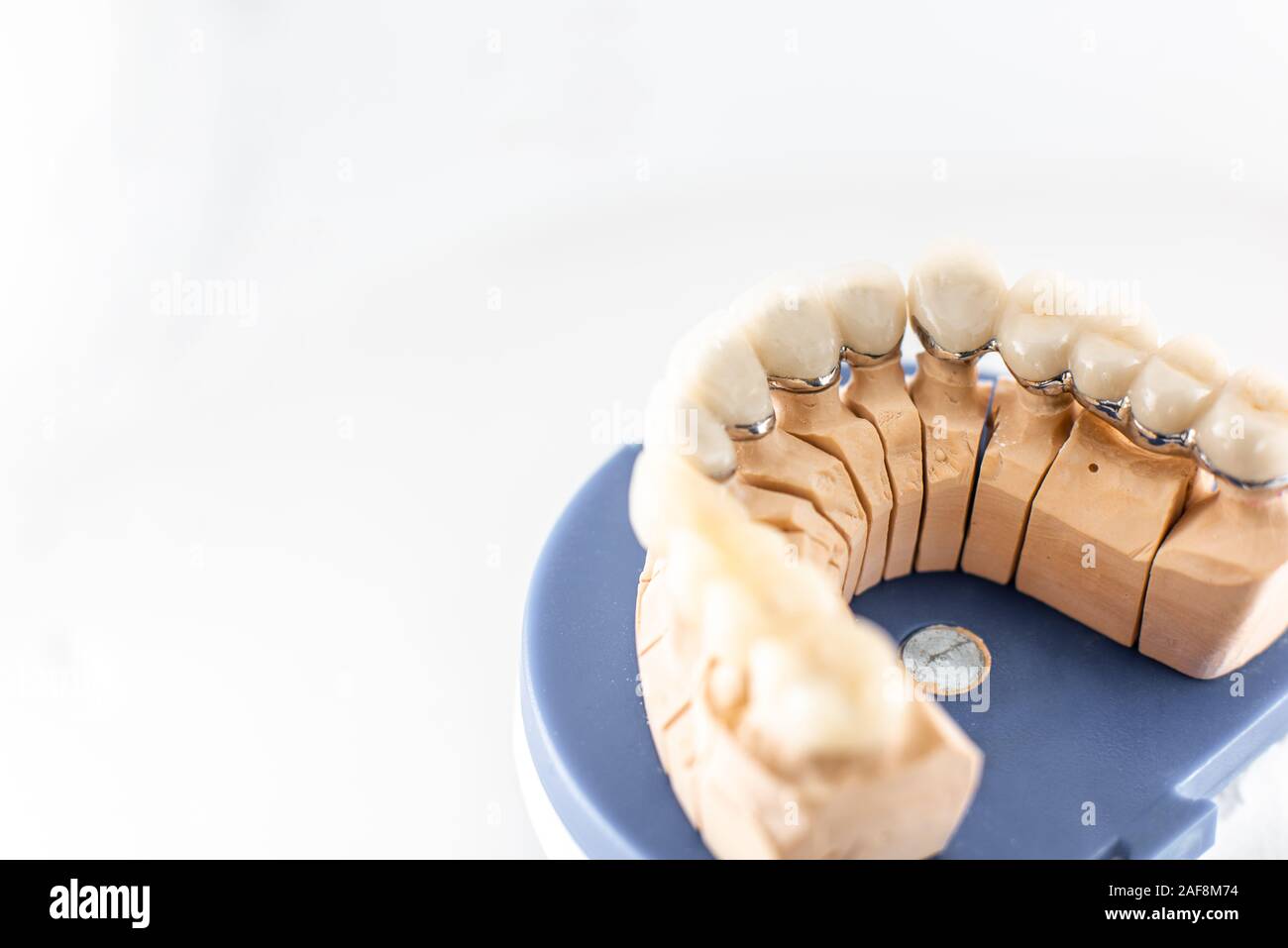 Cose up studio shot of dental mentions légales avec les dents artificielles sur un laboratoire dentaire workbench. Concept de modélisation des dents artificielles Banque D'Images