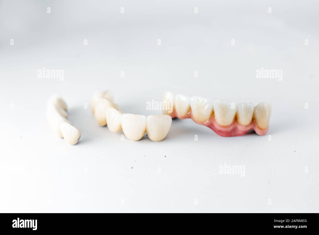 Close-up sur les couronnes dentaires sur le fond blanc. Concept de la prothèse et de l'implantation en dentisterie Banque D'Images