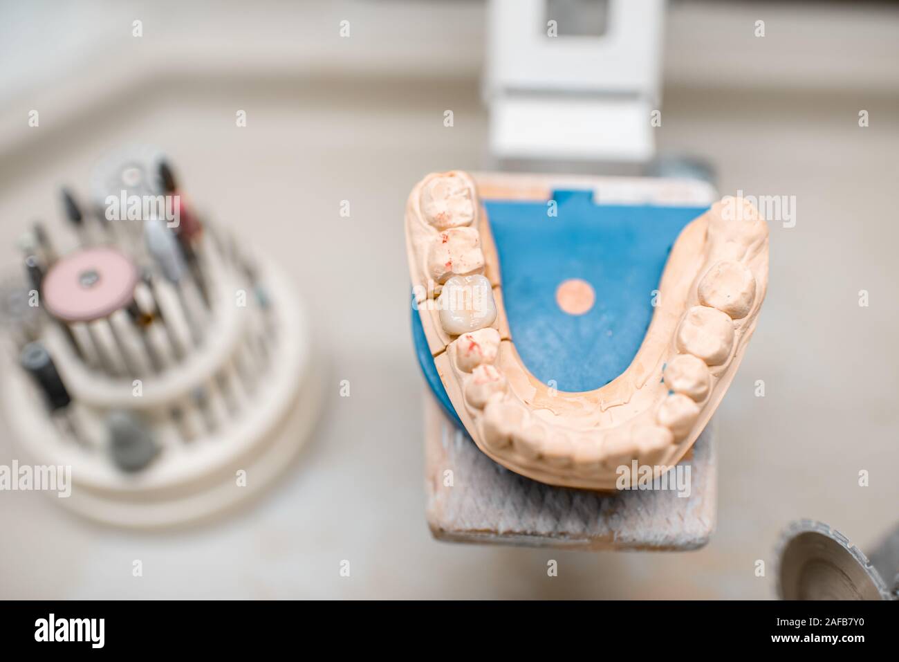 Mâchoire artificielle pour la modélisation des implants avec jeu de fraises dentaires sur le lieu de travail de technicien en laboratoire dentaire Banque D'Images