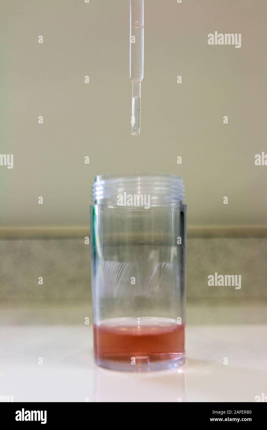 Micro-titration à l'aide d'une pipette en plastique et un petit flacon. Mélanger avec de l'acide chlorhydrique et hydroxyde de sodium en utilisant phenylthalien comme un indicateur. Banque D'Images