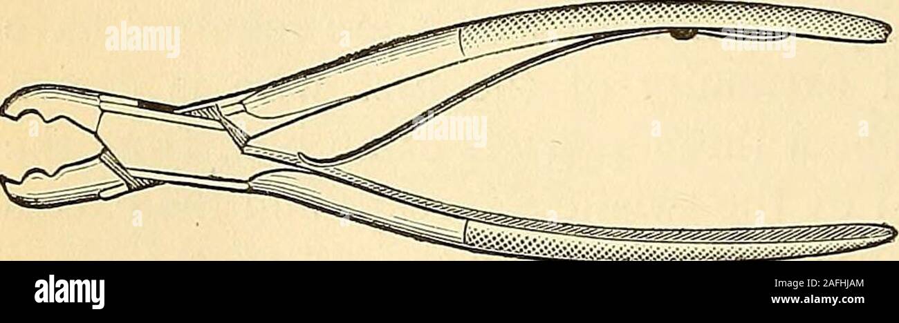 . Les principes et la pratique de la chirurgie. ns forceps (Fig.447)2 intoa selle, sur le fistulousedges, qui sont établis dans sa voûte par les sutures, passant d'un throughholes" les uns des autres, sur le milieu. (Voir Fig. 448.) Les sutures,pour la première fois, de déterminer la longueur du bouton et le nombred'trous qui doivent être faites. La longueur de la Fig. 448 est de 1 pouce. C'est un adaptedto§ - fistule d'un pouce de long. En arquant le bouton, la région fistuleuse bords sont tirés hors de la ligne directe de la souche sur les sutures, tandis qu'un soutien plus régulier et plus secureprotection alonecan que la suture interrompue giv Banque D'Images