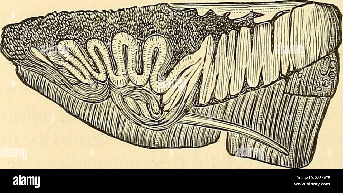 . Les principes et la pratique de la chirurgie. m ; mais toutes les parties de la muqueuse glandulaire tegumentary,et structures sont susceptibles d'épithélioma. Avant tout, cependant, il s'attaque très rarement les glandes lymphatiques. Dans de rares et ex- 504 ÉPITHÉLIOMA. ceptional cas, aussi, il a été rencontré dans la structure du cœur, poumons, foie, et dans diverses autres parties du corps. L'apparence particulière de chaque cas, selon que l'itattacks principalement l'un ou l'autre structure, seront décrites avec inconnection les accidents et maladies chirurgicales de l'variousregions du corps. C'est seulement couper au besoin Banque D'Images