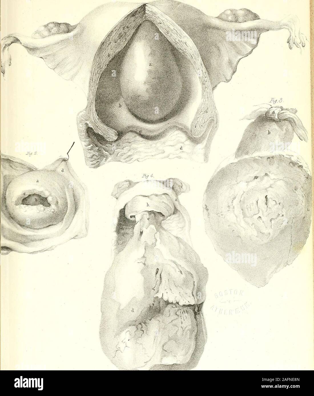 . Les principes et la pratique de la médecine obstétricale : dans une série de dissertations systématiques sur les sages-femmes, et sur les maladies des femmes et des enfants, illustré par de nombreuses plaques. 4^/^- T13A :.^serrlgcrd yi AfZ M ajik/jir. -4c JraHid. Tiy CMiBmmiM. VvOr,c(^. .Voile : /. Banque D'Images