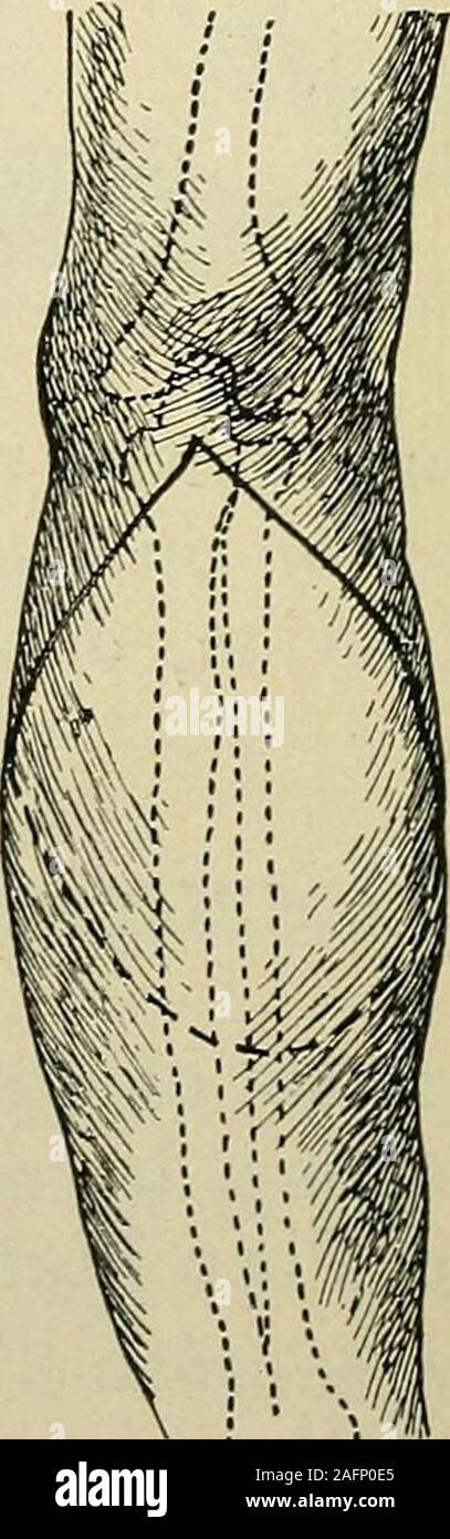. Chirurgie Mineure et des bandages ; y compris le traitement des ...